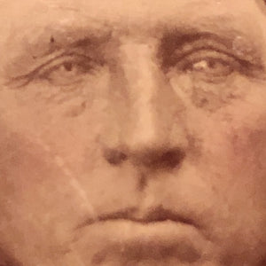 Antique Tintype of Creepy Dude with Dead Eyes and Hairy Neck