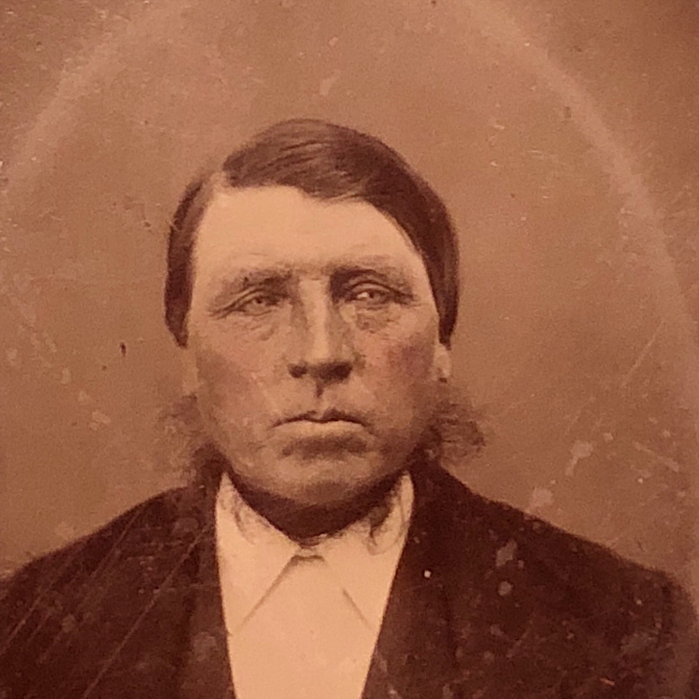 Antique Tintype of Creepy Dude with Dead Eyes with Hairy Neck Monster - Late 1800s
